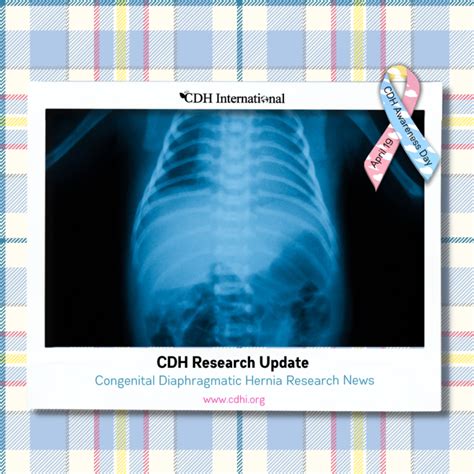 Cdh International A Global Initiative To Stop Congenital