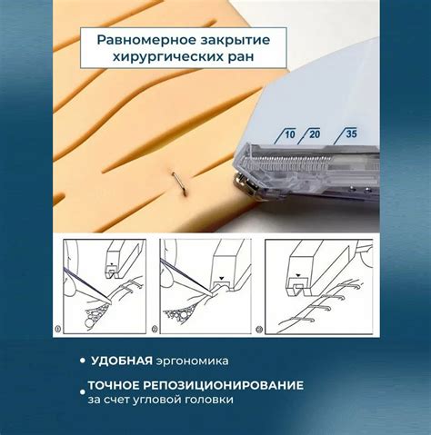 Meril Mirus Skin Stapler Кожный степлер – 35W с 35 стандартными ...