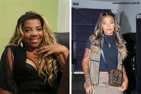 Ludmilla Antes E Depois Da Cantora Ap S Cirurgias Pl Stica Dos Famosos