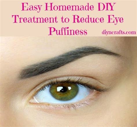 Easy Homemade DIY Treatment to Reduce Eye Puffiness - DIY & Crafts