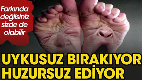 Huzursuz bacak sendromu uyku kaçırıyor