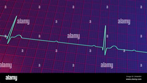 Illustration Of An Electrocardiogram Ecg Depicting A Complete Heart