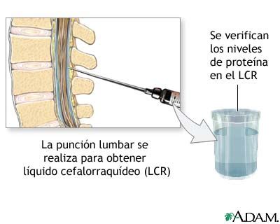 Medlineplus Enciclopedia M Dica Examen De Prote Na Del Lcr