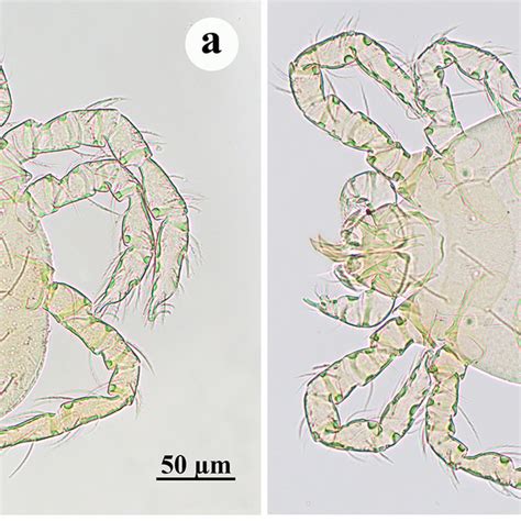 A Specimen Of Ectoparasitic Mite Eutrombicula Alfreddugesi