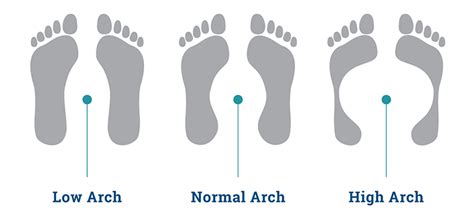 Know Your Arches - ShoeInsoles.co.uk