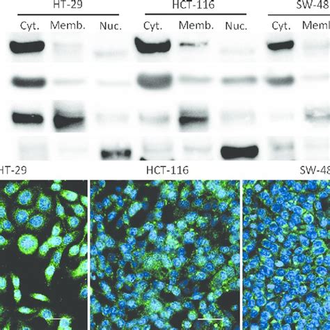 Subcellular Localization Of PDE10 In Human Colon Tumor Cell Lines A