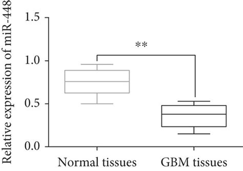 Mir 448 Was Downregulated In Gbm A The Mrna Mir 448 Expression In Download Scientific