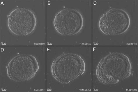 Overview Of Microscopy Techniques Confocal Widefield Transmitted