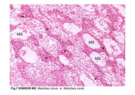 Block2/Fig.7 Photomicrograph of the medulla of a lymph node.