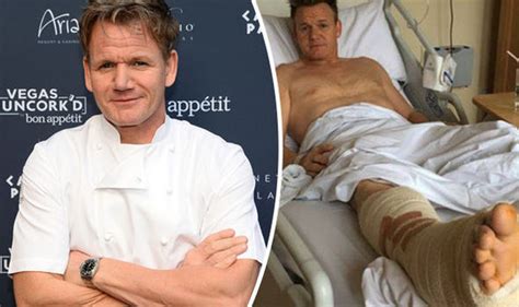 Gordon Ramsay Shares Hospital Snap After Surgery On Ruptured Achilles