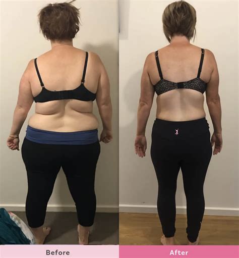 Mom Of Hannah Shares Her Mind Blowing Back Transformation The