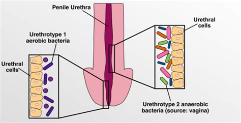 Healthy Men Who Have Vaginal Sex Have A Disti Eurekalert