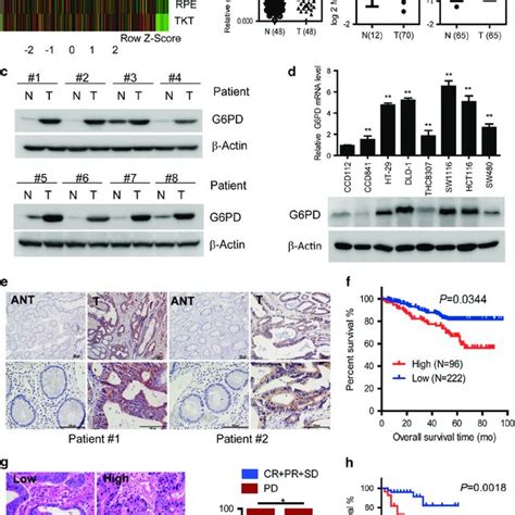 Knockdown Of G Pd Enhances Oxaliplatin Induced Apoptosis In Crc Cells