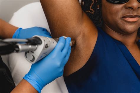 Debunking Myths About Laser Hair Removal For Darker Skin Essence