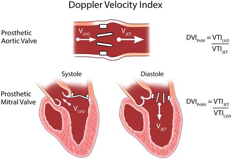 Guidelines For The Evaluation Of Prosthetic Valve Function With