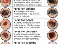sun spftanning sun damage skin cancer