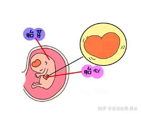 B超单上的孕囊、胎心、胎芽胚芽分别代表什么？ 知乎