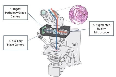 Microscope Based-Digital Pathology System | Augmentiqs