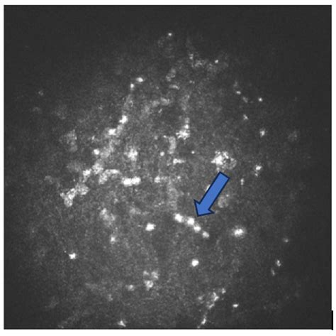 Biology Free Full Text New Frontiers In Acanthamoeba Keratitis Diagnosis And Management