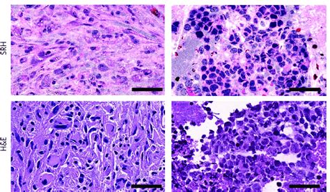 Images From Stimulated Raman Histology Srh And Conventional