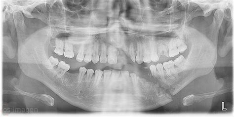 Os Imagen Central De Radiología Digital