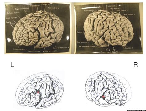 Albert Einstein S Brain 12 Facts About Gray Matter Of Scientific