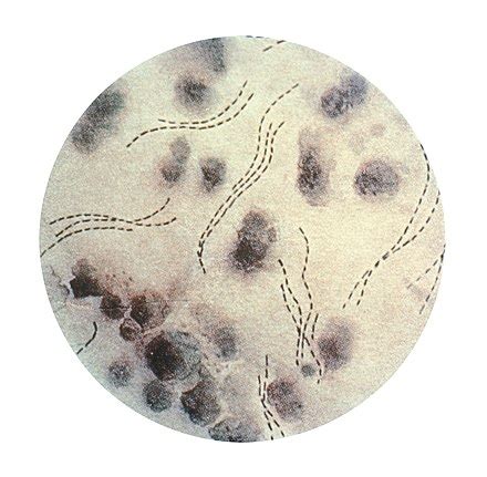 Haemophilus ducreyi - Wikipedia