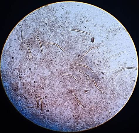 Stool Microscopy Showing Rhabditiform Larvae Of S Stercoralis Which Download Scientific