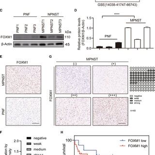 Nuf Promotes Nf Associated Mpnst Cell Proliferation In Vitro A