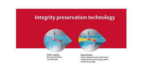 INSPIRIS RESILIA valve features | Edwards Lifesciences