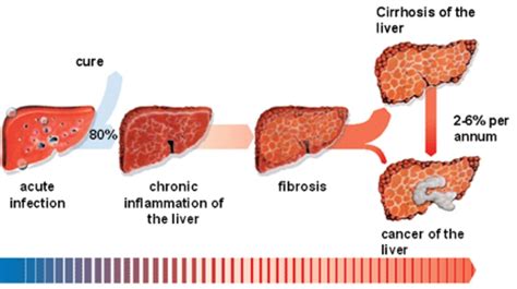 Panel viral: HEPATITIS | Mind Map