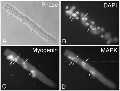 Isolation And Culture Of Skeletal Muscle Myofibers As A Means To