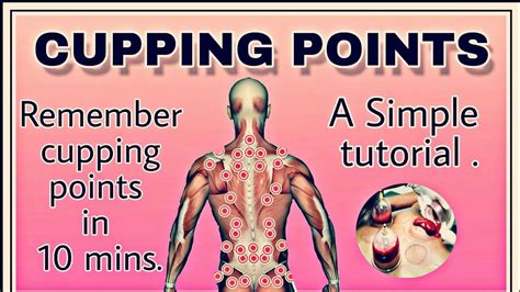 Cupping Points Hijama Points Cupping Points Hijama Cupping Therapy