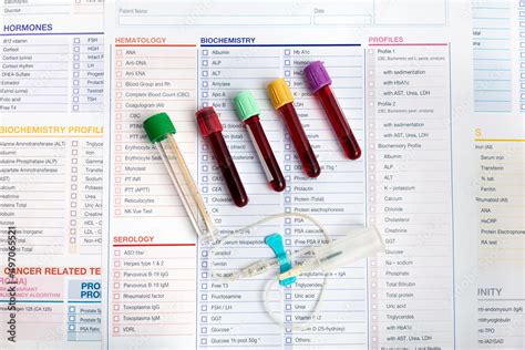 Zdj Cie Stock Workplace Of Laboratory With Blood Tubes Samples And