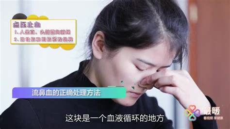 16流鼻血正确的处理方法 健康视频 搜狐视频