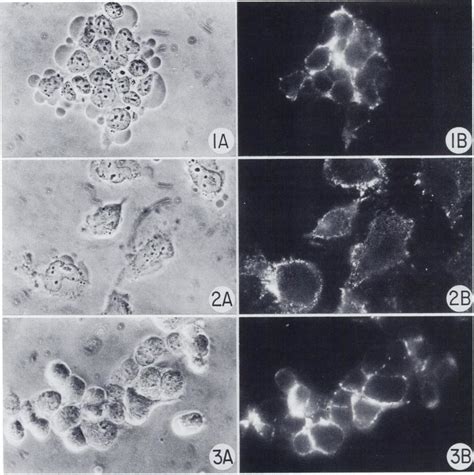 Phase Contrast Bright Field I And Fluorescent 0 Photomicrographs