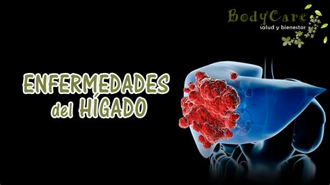 Enfermedades del hígado Salud y bienestar