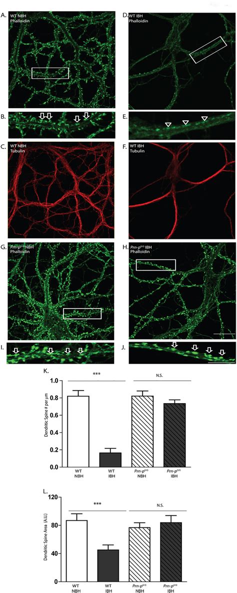 Scrapie Infected Brain Homogenate Causes Prpc Dependent Loss Of