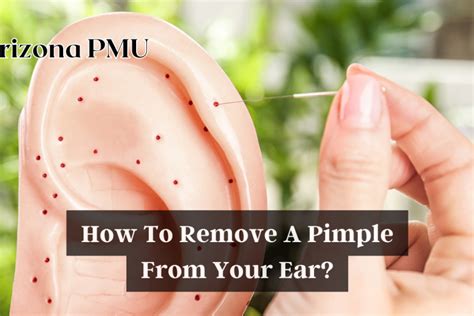 How To Remove A Pimple From Your Ear Arizona Pmu