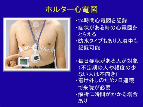 不整脈って何？ ～診断から治療まで～ らくわ健康教室 講演録