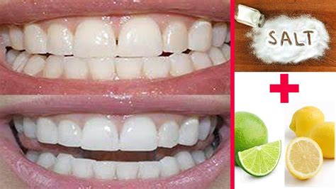 What Is The Best Way To Whiten Your Teeth Using Home Made