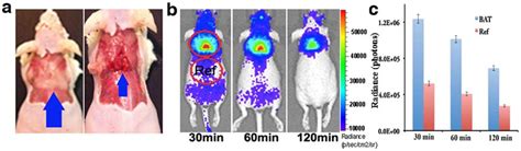 Cli Imaging Of The Interscapular Bat A Triangular Contour Of