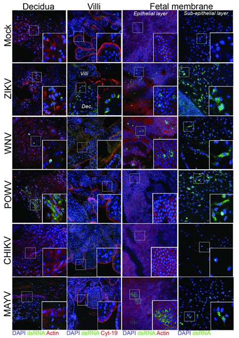 All in the Family: Relatives of Zika Virus Ma | EurekAlert!