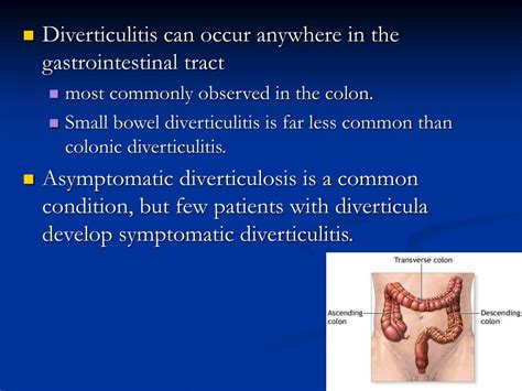 Ppt Diverticulosis And Diverticulitis Powerpoint Presentation Free