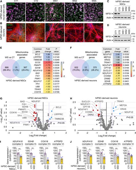 Depletion Of Wfs Compromises Mitochondrial Function In Hipsc Derived