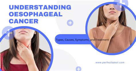 "Understanding Oesophageal Cancer: 3 Types, Causes, Symptoms, And ...