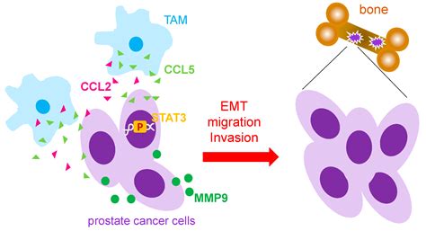 Life Free Full Text Impact Of Immune Cells In The Tumor