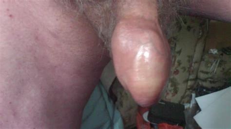 Foreskin Baby Oil And Three Highlighters Free Gay Porn 18 XHamster