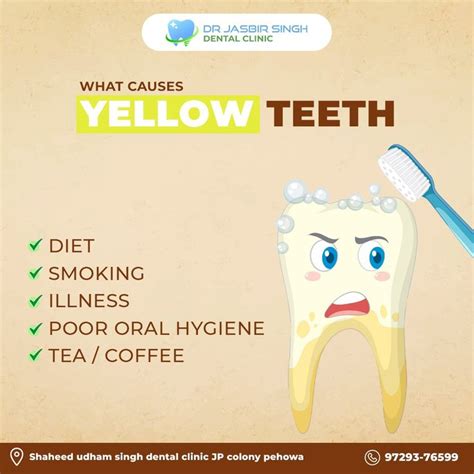 What causes YELLOW teeth? 👆 in 2023 | Dental clinic, Dental posts ...