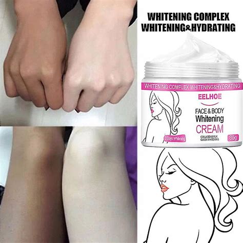 Body Whitening Cream Underarm Armpit Knee Dark Skin Bleaching